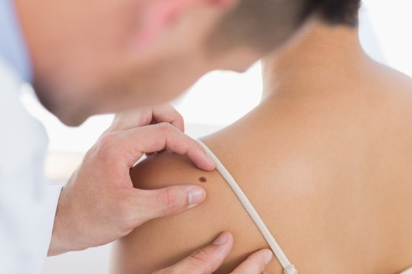 Besplatan pregled mladeža i tumora u Domu zdravlja Tuzla Besplatan pregled mladeža i tumora u Domu zdravlja Tuzla