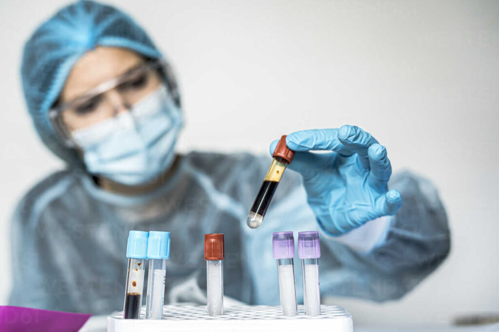 Imunološki sistem razvija dugoročnu odbranu nakon blažeg oblika Covida-19 1 blood test tube with label of covid 19 also known as coronavirus or novel corona in scientist hand in laboratory female scientist is wearing highly protective suit gloves mask and glasses CAVF93210
